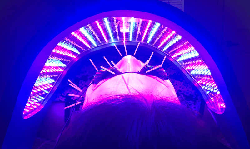 Cosmetic Acupuncture: Facial Acupuncture with Celluma LED Light Therapy
