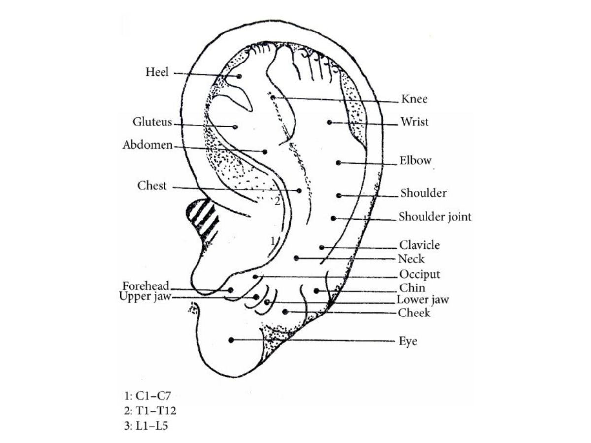 Diagram of the inverted fetus map used in auricular acupuncture, showing how different points on the ear correspond to body areas such as the heel, gluteus, abdomen, chest, joints, and facial features; often referenced in acupuncture treatments for stress and overall wellness.