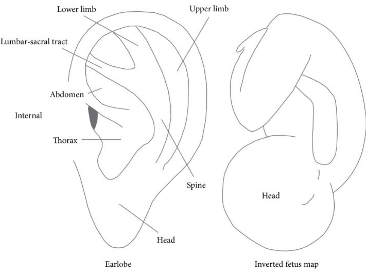 Diagram comparison of the inverted fetus map used in auricular acupuncture, showing how the fetus image fits within the ear.