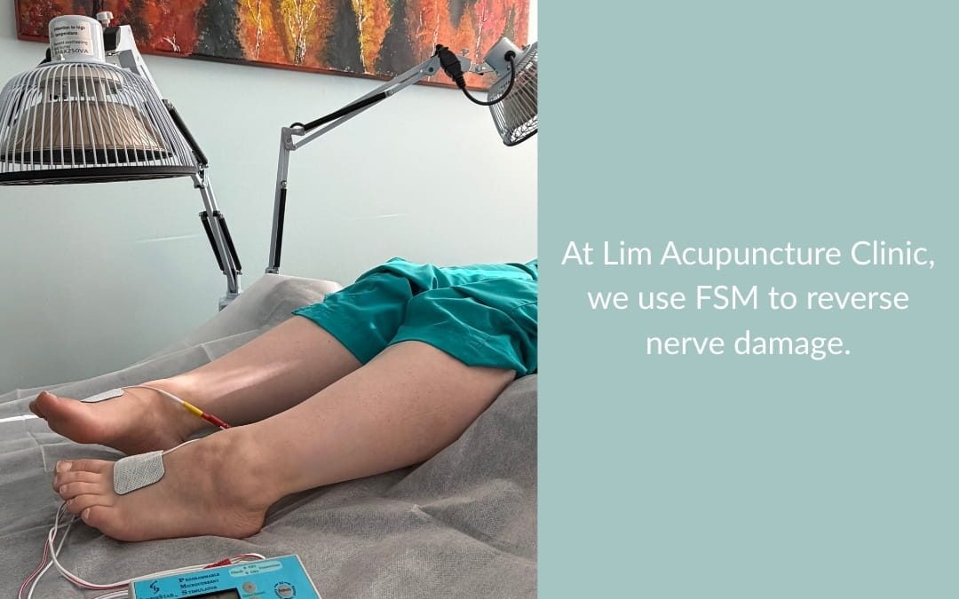 Frequency Specific Microcurrent: A Gentle Addition to Acupuncture Care