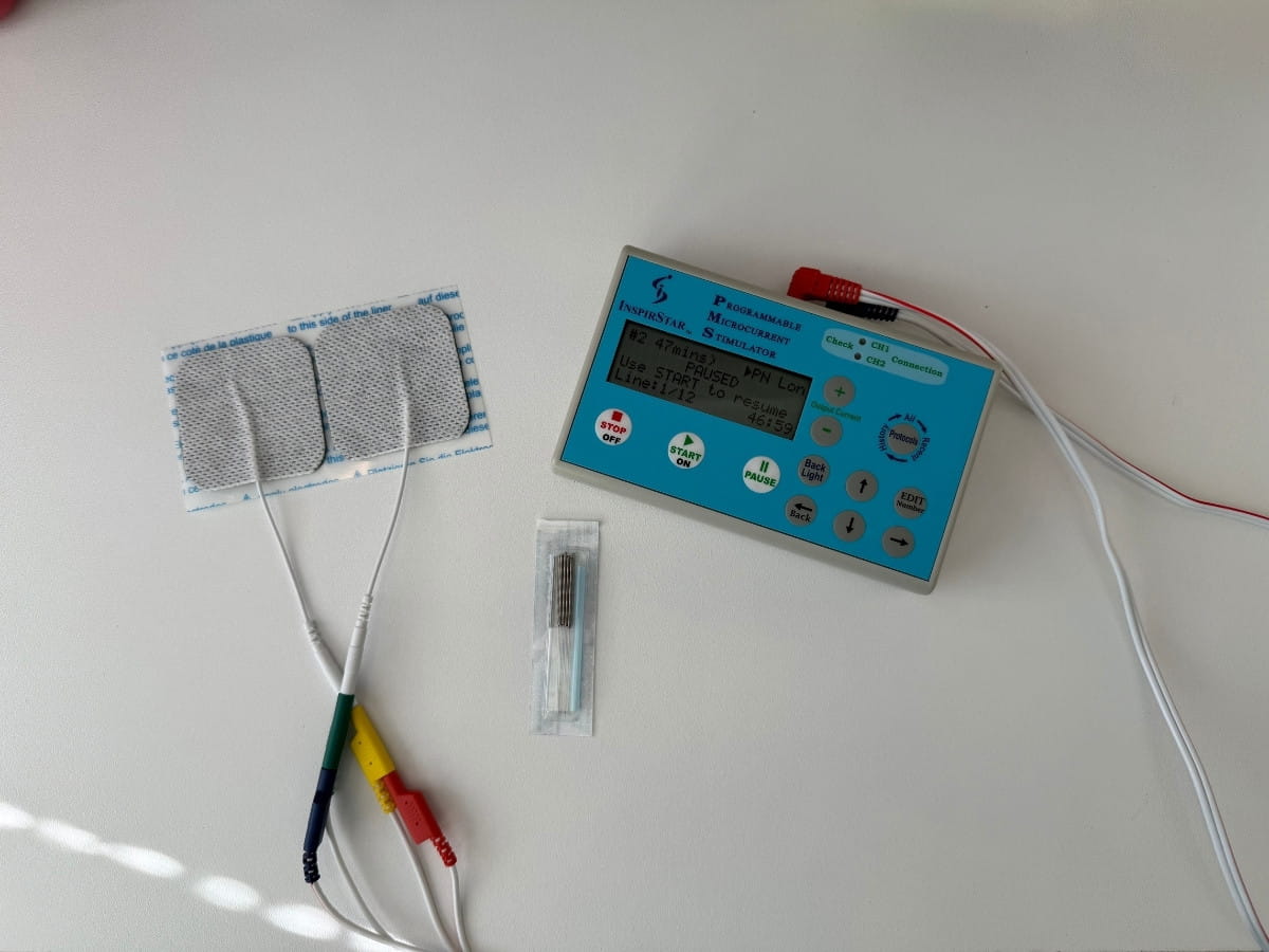A FSM device next to acupuncture needles showing both treatments together.