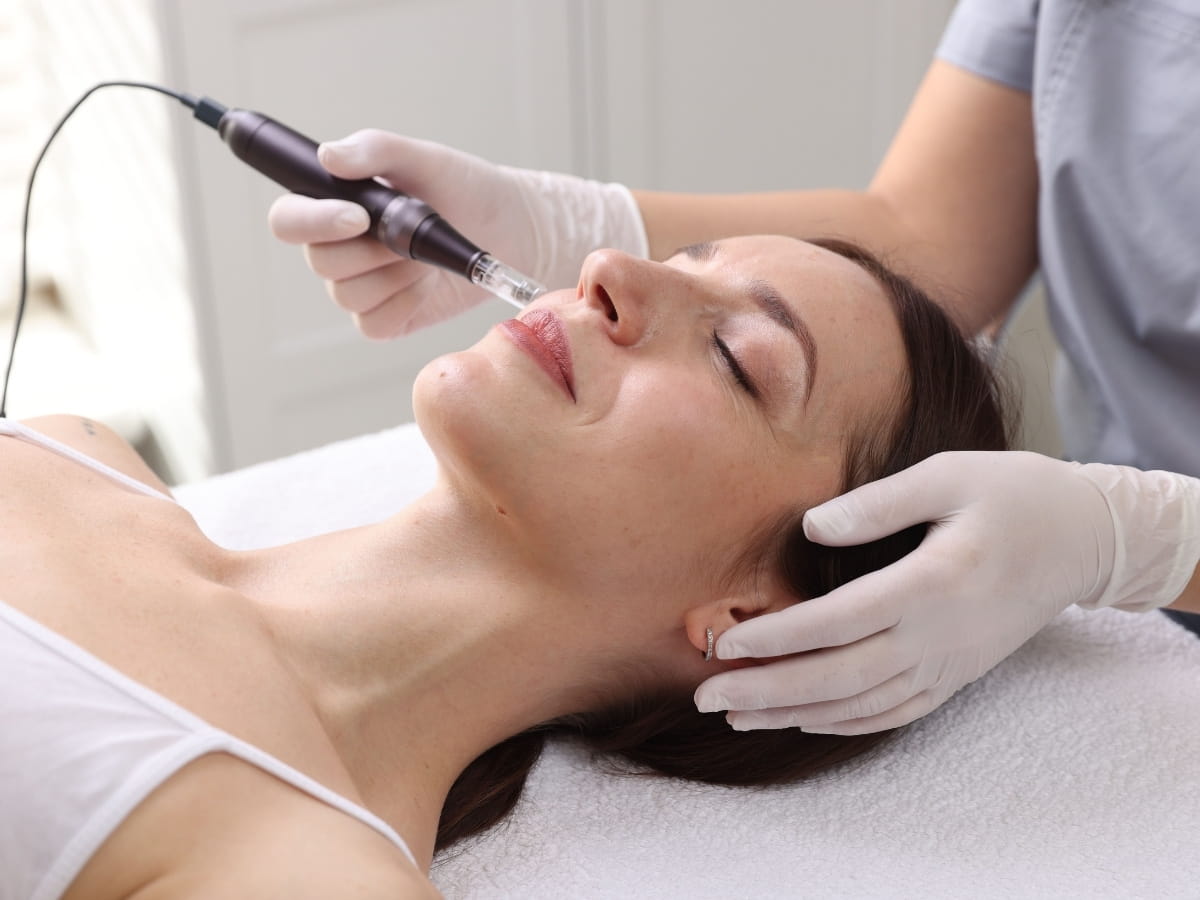 A patient receiving a microneedling treatment in a calm, clean clinic environment. 