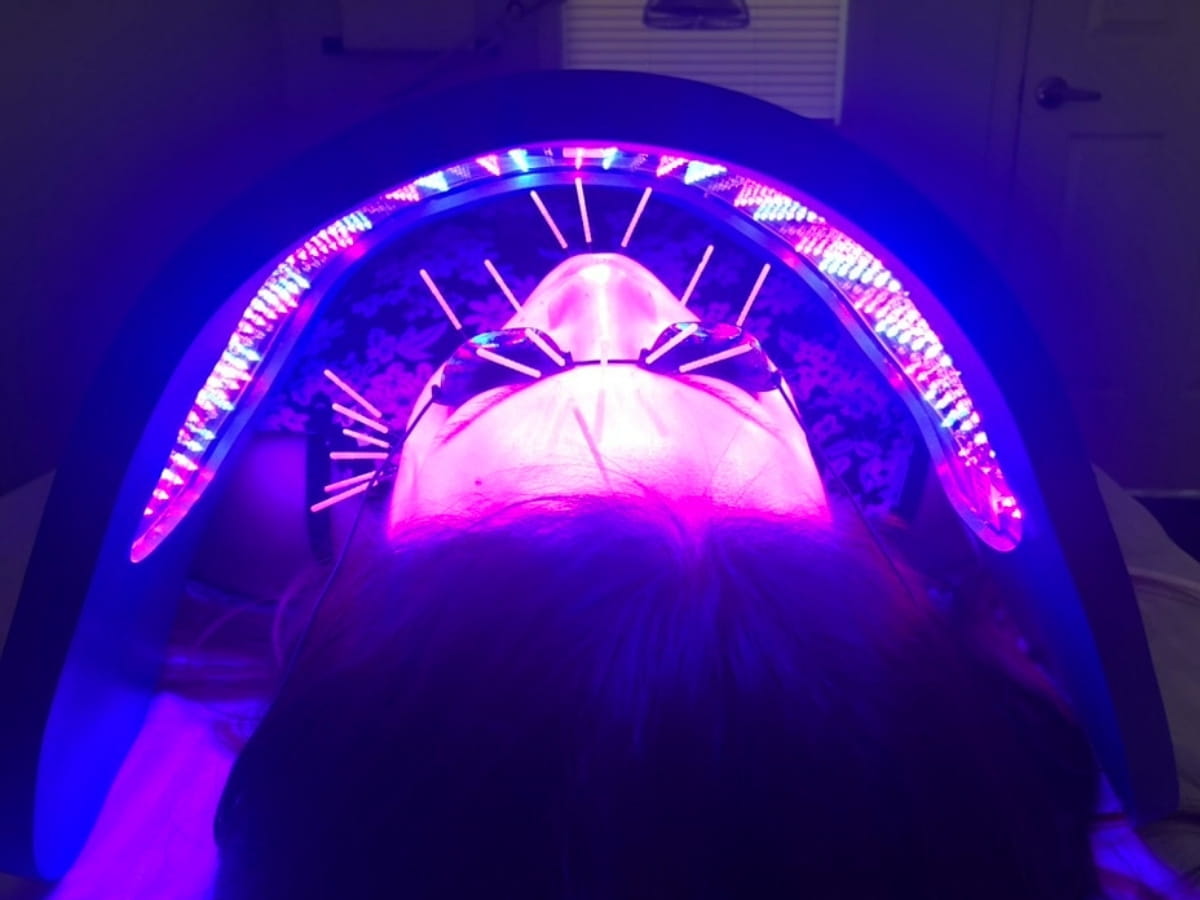 A real patient at Lim Acupuncture Clinic receiving Facial acupuncture treatment with Celluma LED light therapy supporting natural anti-aging and collagen stimulation.