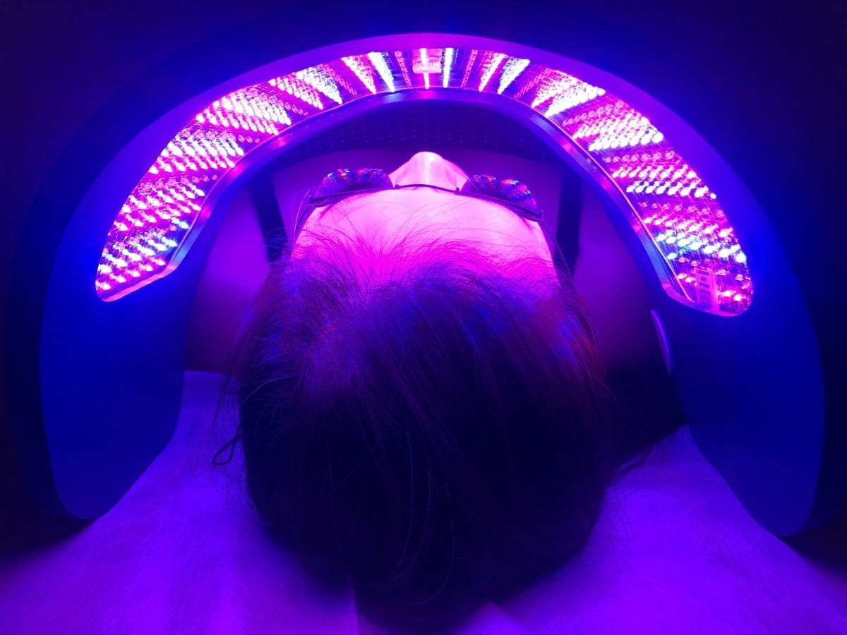 A real patient from Lim Acupuncture Clinic receiving facial Celluma LED Light therapy for acne treatment.
