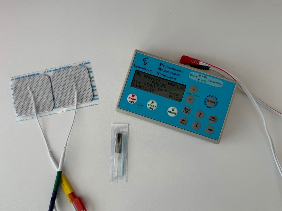Frequency Specific Microcurrent (FSM) device and acupuncture needles used for peripheral neuropathy treatment.