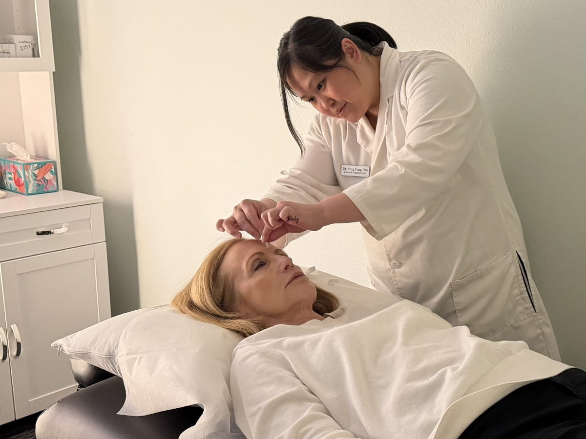 Dr. Lim performing facial acupuncture points to alleviate symptoms due to Seasonal Allergies