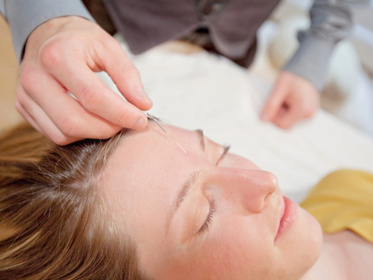 A postpartum mother receiving acupuncture as part of her postpartum care treatment plan.