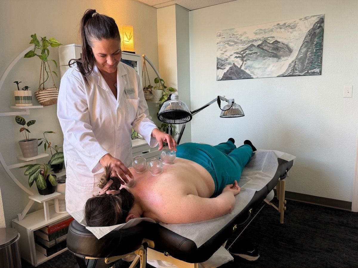 Licensed acupuncturist, Brenna Lewis, preforming back dynamic fire cupping on a patient at Lim Acupuncture Clinic.